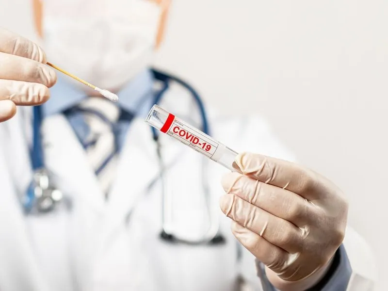 Testovi na korona virus - PCR, antitela, privatne laboratorije