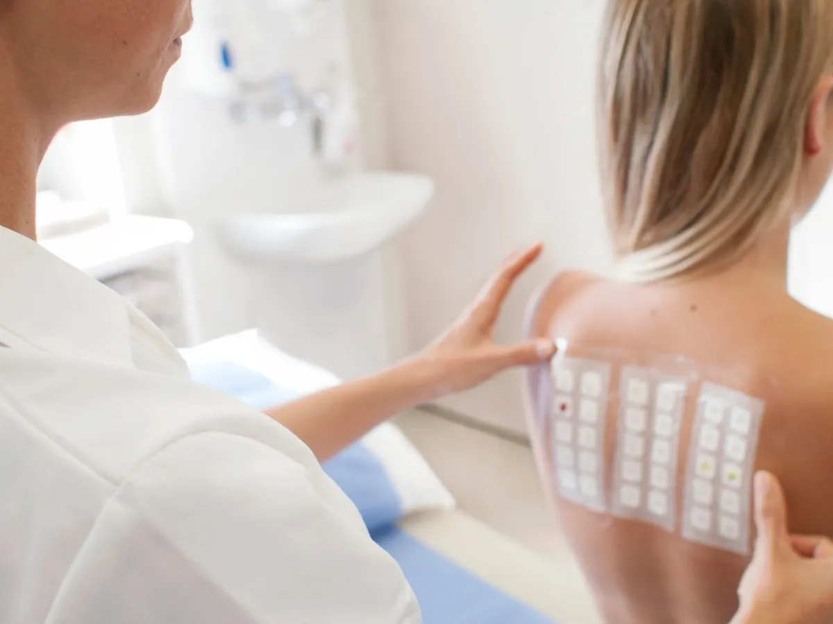 Patch test (Test za otkrivanje ekcema)