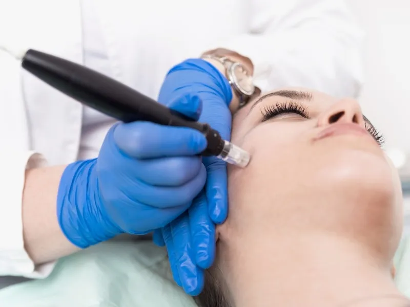 Biorevitalizacija