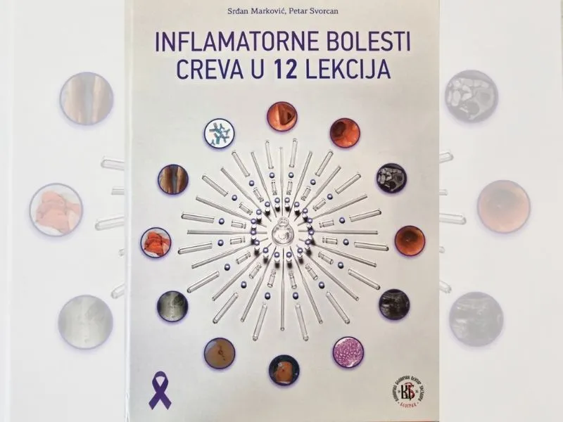 Objavljena monografija “Inflamatorne bolesti creva u 12 lekcija”