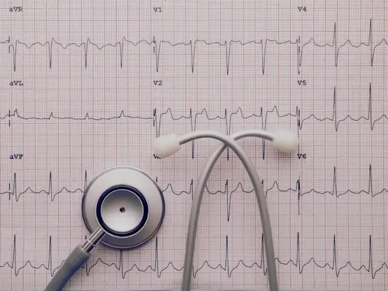 Šta je EKG i šta pokazuje?
