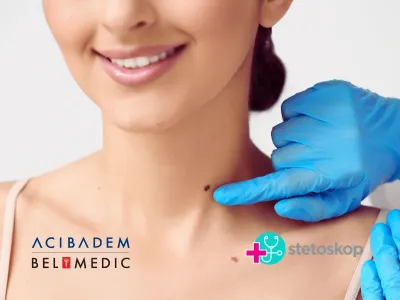 Pregled mladeža: kada je vreme da odete kod dermatologa?