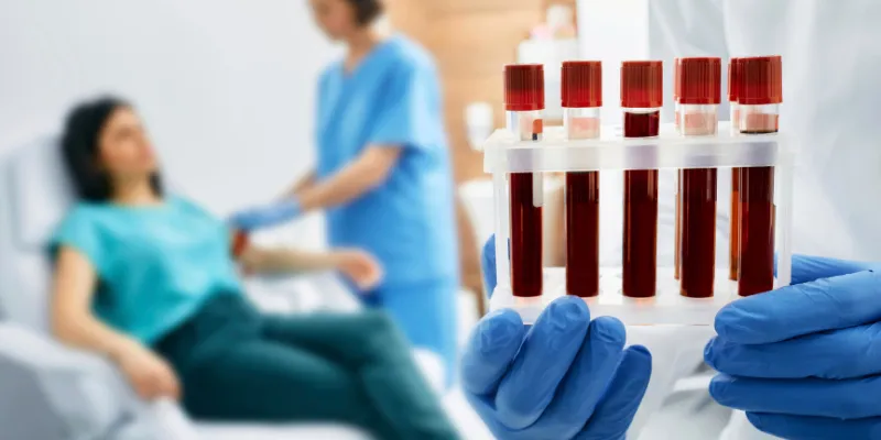 laborant-drži-ampule-sa-uzorcima-krvi_-dok-se-u-pozadini-drugi-laborant-bavi-davaocem-krvi.webp Laborant drži ampule sa uzorcima krvi, dok se drugi laborant bavi pacijentom