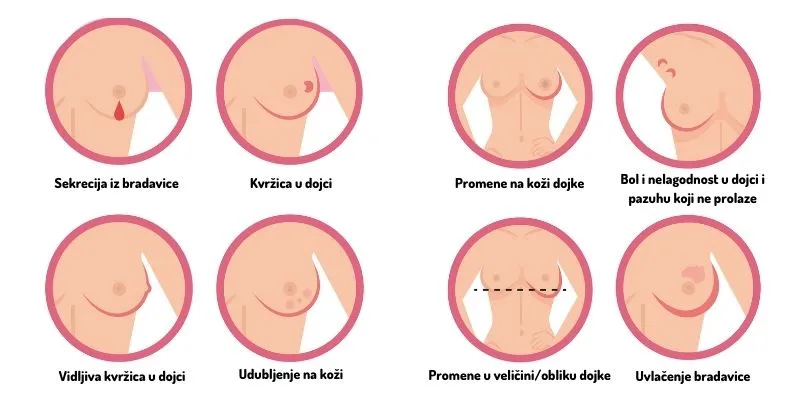 Promene na dojci.jpg