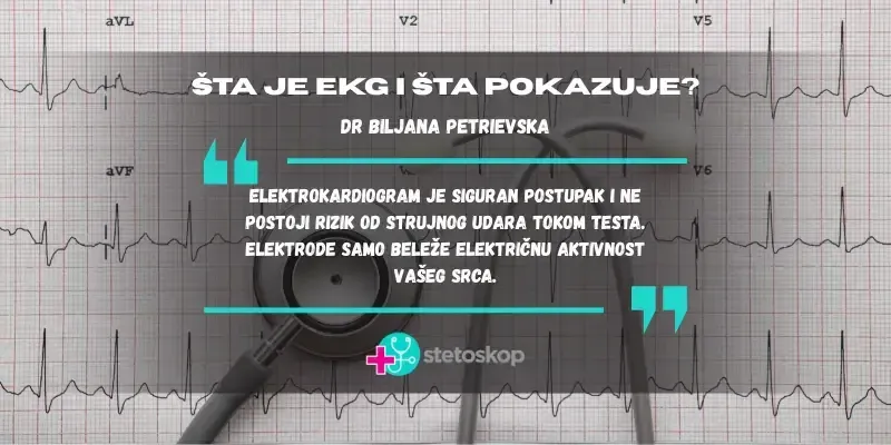ekg_slika.webp