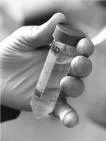Novi lek protiv HIV-a ohrabrujuće efikasan