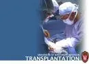Prva transplantacija pluća seropozitivnom pacijentu