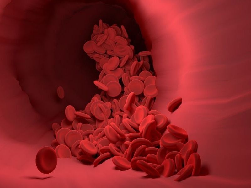Angiografija (Arteriografija)