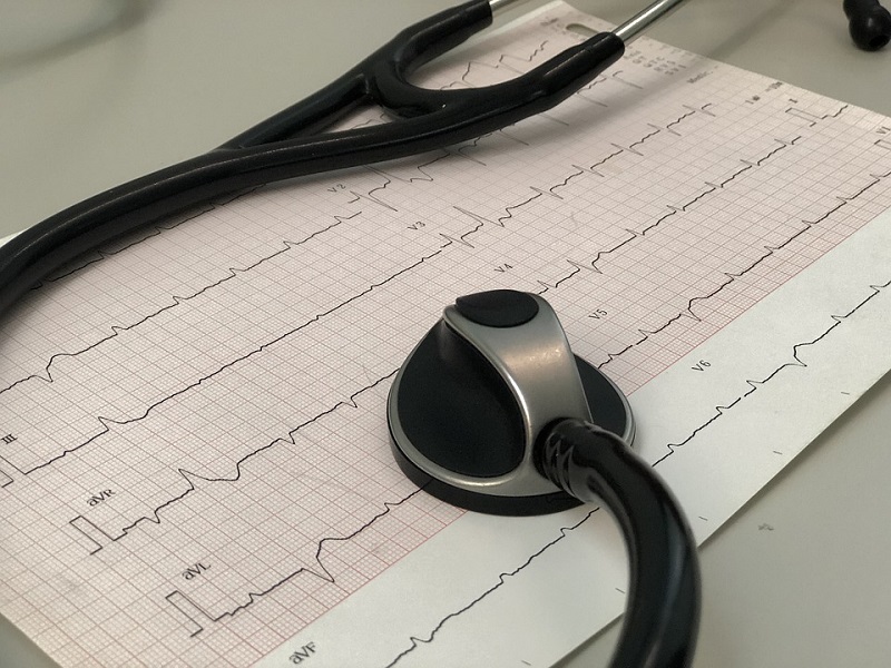 Elektrokardiogram (EKG)