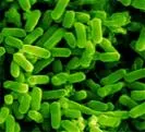 Escherichia coli (Eserihija coli) infekcija