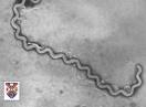 Leptospiroza