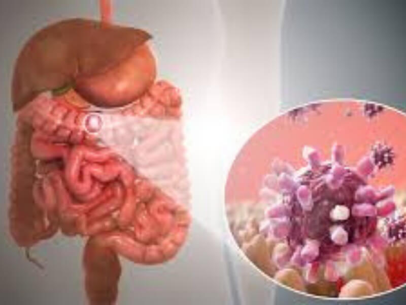 Gastroenteritis