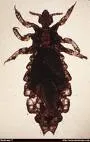 Vašljivost glave (Pediculosis capitis)