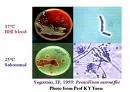 Penicilioza
