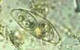 Izosporijaza