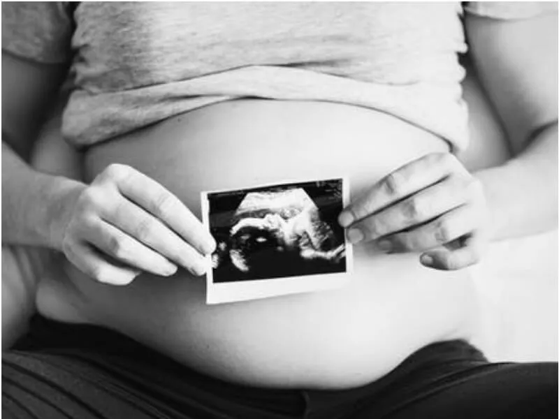 Arteficijelni abortus