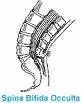 Okultna spina bifida