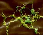 Borrelia burgdorferi