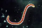 Leptospira interrogans