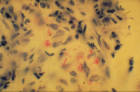 Mycobacterium leprae