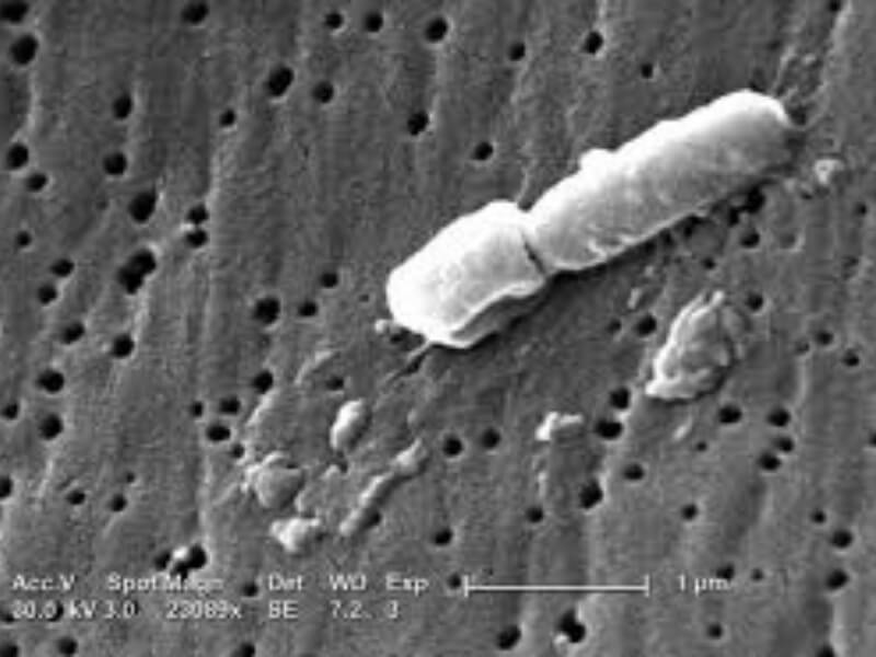 Klebsiella pneumoniae ss. pneumoniae