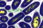 Haemophilus Ducreyi