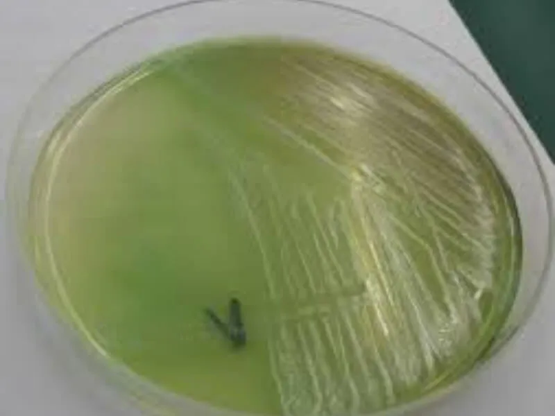 Pseudomonas aeruginosa