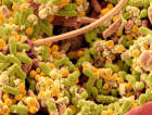 Streptococcus pyogenes