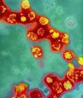 Rubella virus