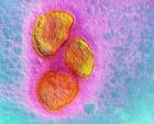 Virus Mumpsa