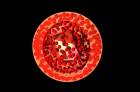 Herpes simplex virus