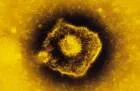 Varicella zoster virus