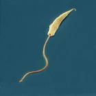Leishmania