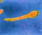 Actinomyces israelii