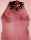 Taenia solium