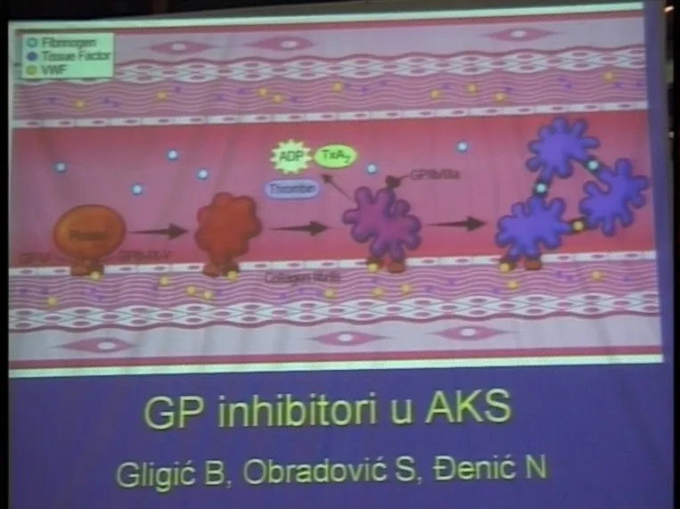 Uloga glikoproteinskih inhibitora u akutnom koronarnom sindromu