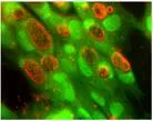 Lymphogranuloma venereum