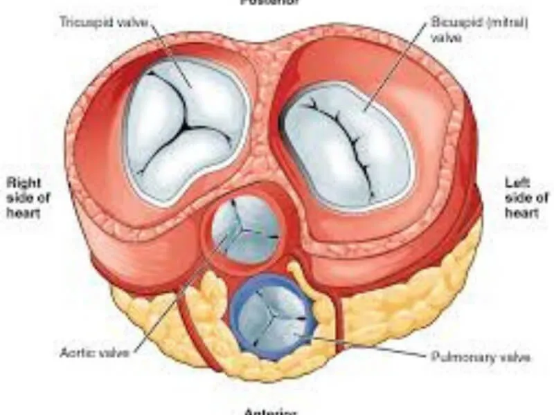Fibroelastoza endokarda