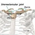 Iščašenje sternoklavikularnog zgloba (luxatio art.sternoclavicularis)