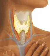 Fibrozni invazivni Tireoiditis