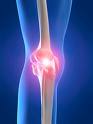 Povrede ligamenta kolena