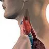 Subakutni tireoiditis