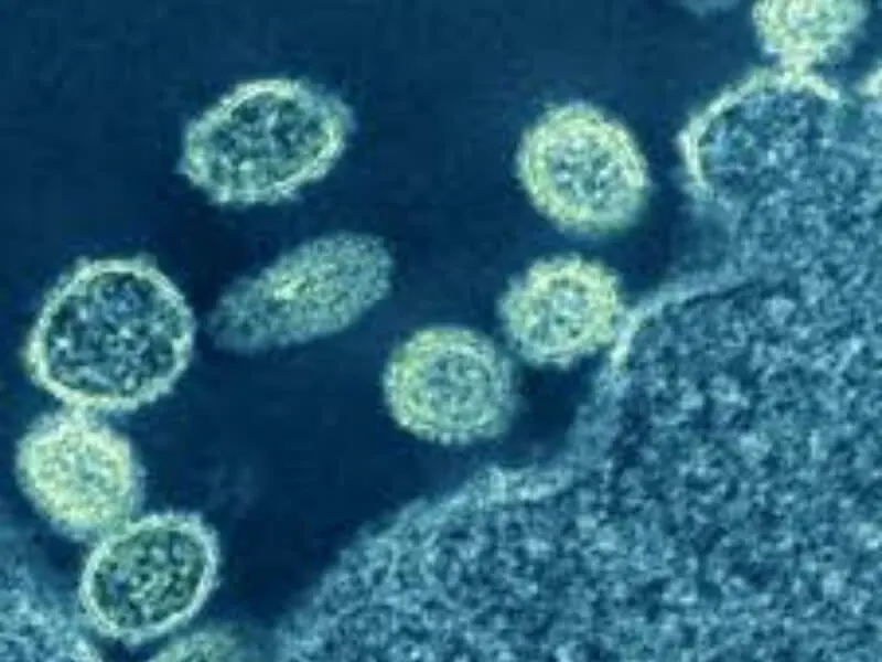 Nove preporuke u vezi sa gripom A H1N1