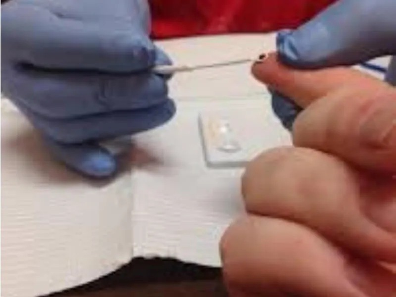 Test za brzo otkrivanje HIV virusa