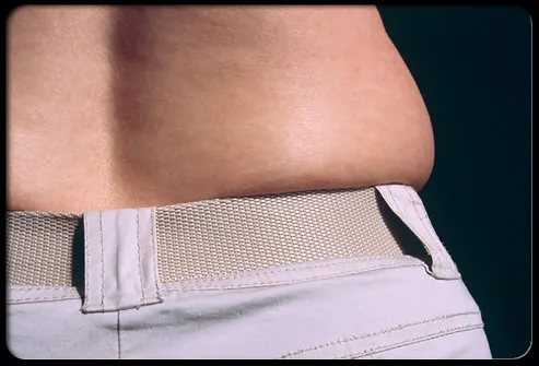 Šta je sa dodavanjem kilograma?